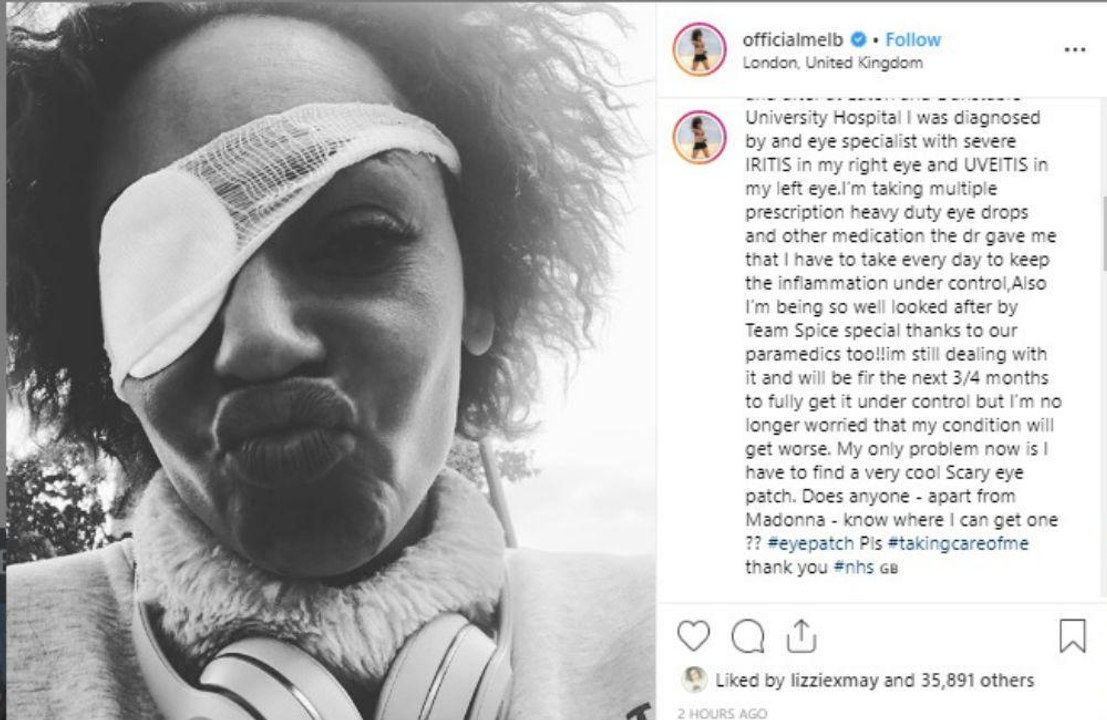 Mel B: Angst vor Erblindung!