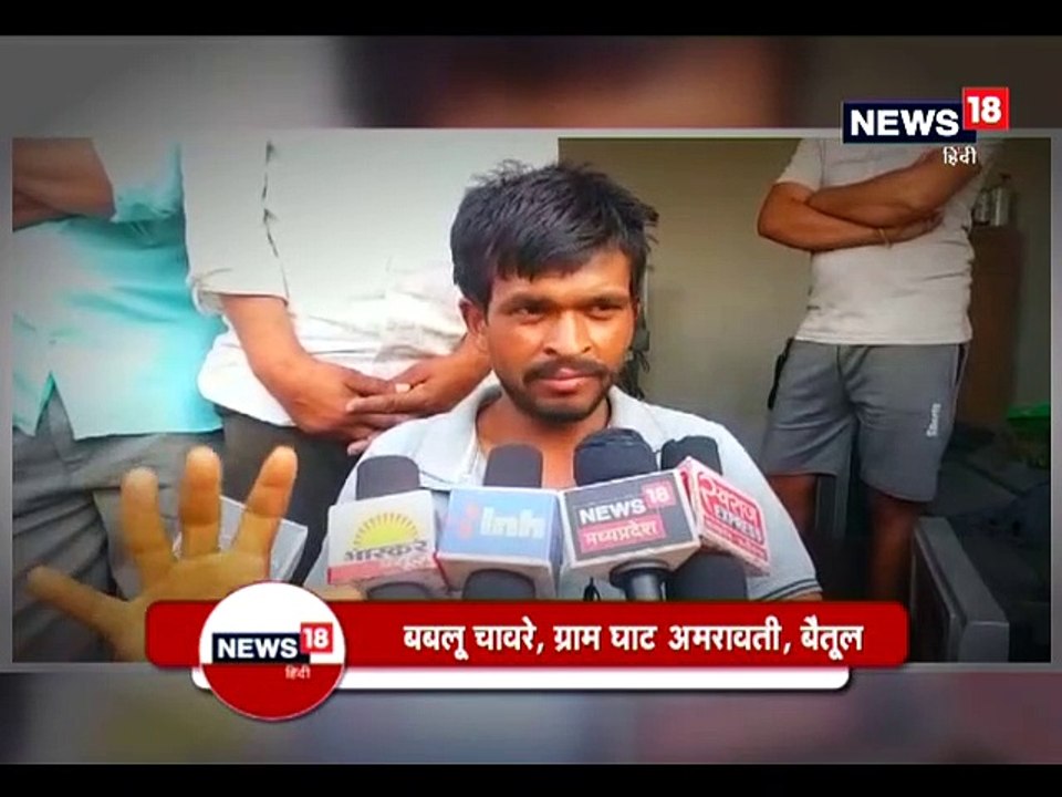 OMG: ये शख्स नाश्ते में ब्रेड, अंडे नहीं बल्कि खाता है कांच के टुकड़े, देखिए VIDEO- This person consumes bread, eggs not in breakfast but pieces of glass, see VIDEO