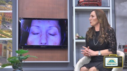 Mjekja dermatologe rrëzon mitin: Nuk shkaktohen vetëm nga dielli, bëni kujdes!!