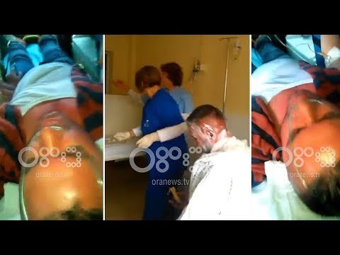 RTV Ora - I fashuar dhe me djegie të rëndë, ky është një nga të plagosurit nga gazi lotsjellës