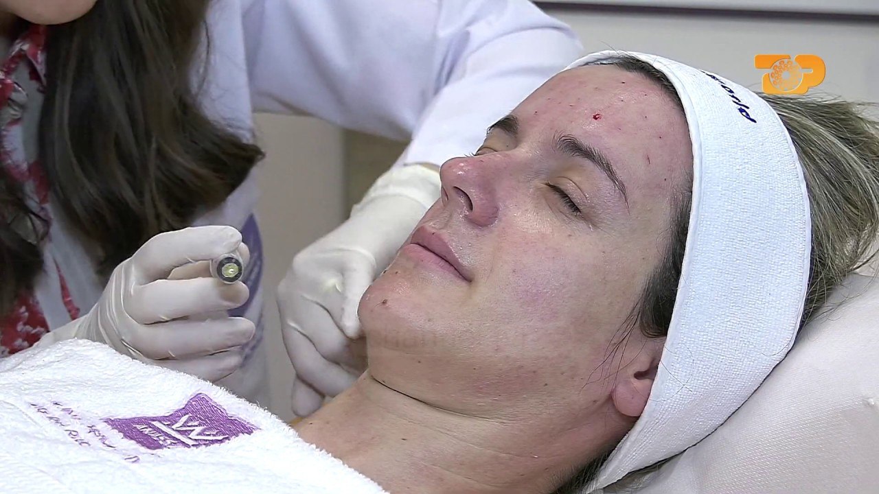 "Klinika "Anassa"- Mezoterapia, terapia më e rekomanduar për stinën e verës "E Diell", 19 maj 2019