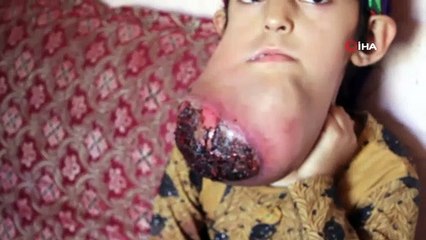 Afganistanlı Küçük Habibe Yardım Bekliyor