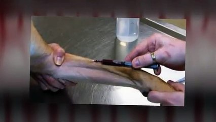 Vein specialists- Susan Bard, M.D.