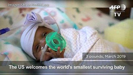 World's smallest surviving baby born in California