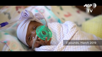 La bebé más pequeña del mundo nace en EEUU pesó lo mismo que una manzana