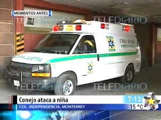 Conejo arranca dedo a niña. (when animals attack)