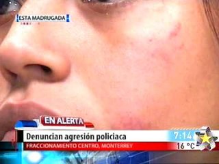 Golpeadas por policias (Fuertes Imagenes)