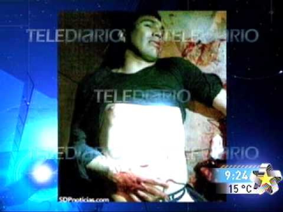 Salvador Cabañas baleado (fuertes imagenes)