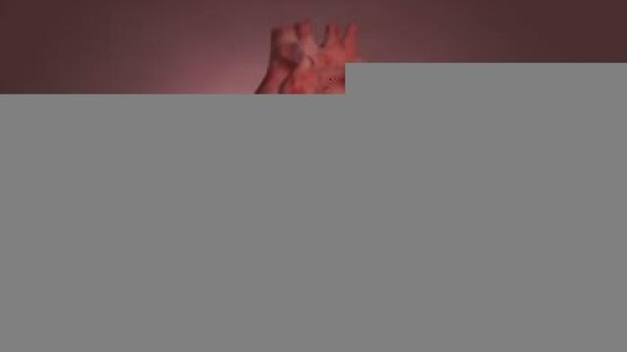 Tecnología y ciencia | Signos externos y visibles que podrían indicar una enfermedad cardíaca