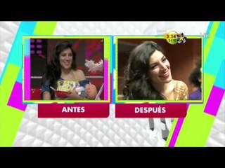 Andy Rodríguez y Flor antes y después