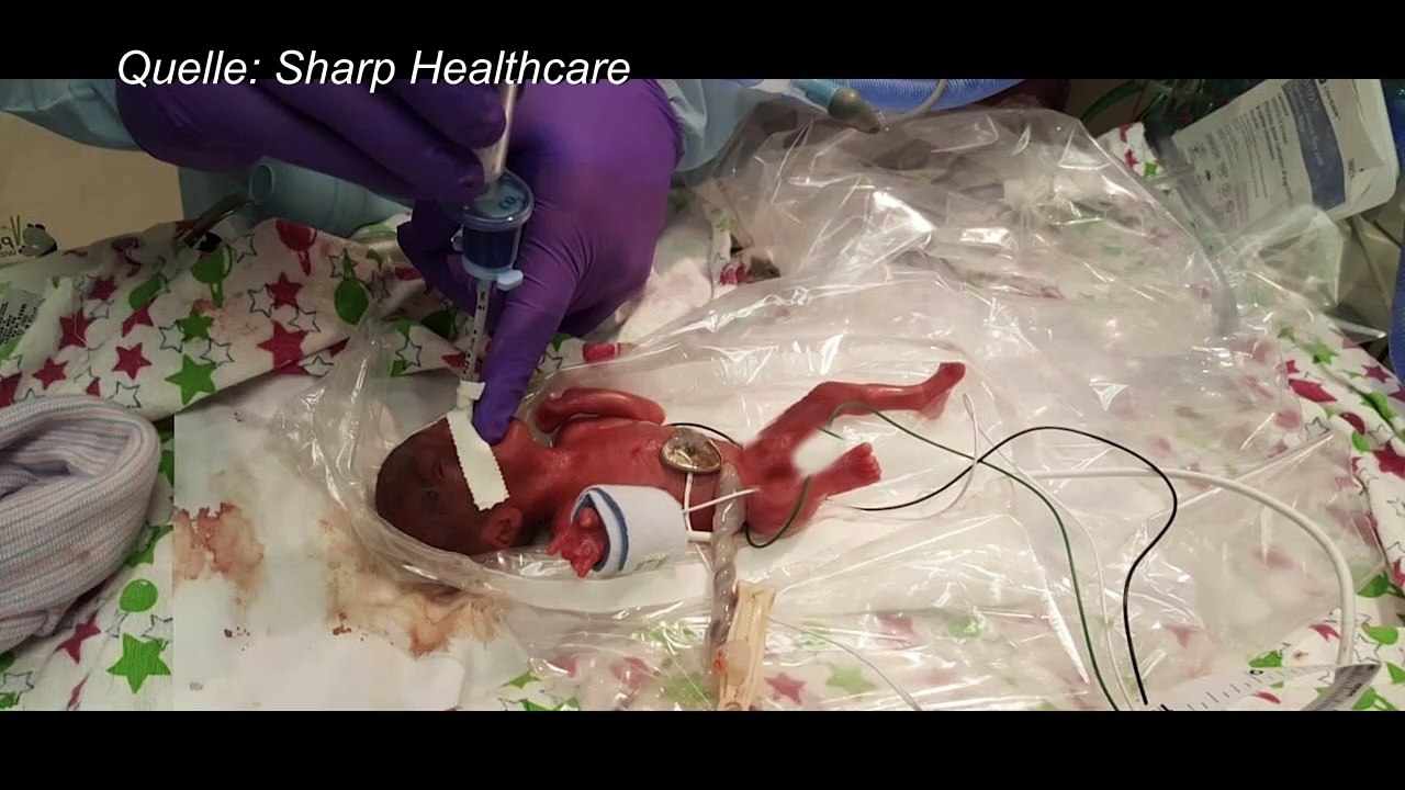 Kleinstes Frühchen der Welt kann Krankenhaus verlassen