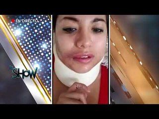 Mariana Ayala sufrió un fuerte accidente | Es Show