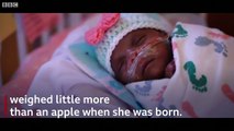 The world's tiniest survivor - BBC News