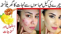 Acne Treatment || remove the acne scars at Home || چہرے کے داغ دھبے جڑ سے ختم