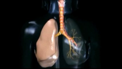 Internacional | La contaminación puede afectar el cerebro