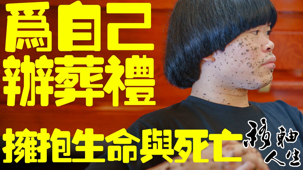 在兒時被診斷患有癌症活不久的斑點人陳偉霖在30歲那年為自己辦了「葬禮」，通過自己的葬禮，擁抱一下生命與死亡 - 移軸人生_2