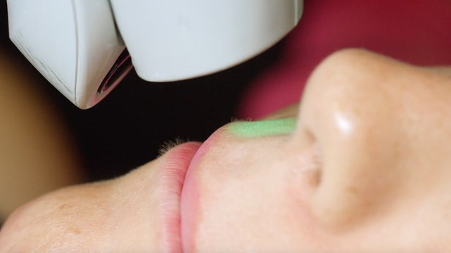 Everything You Need To Know About Laser Hair Removal
