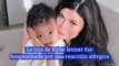 La hija de Kylie Jenner fue hospitalizada por una reacción alérgica