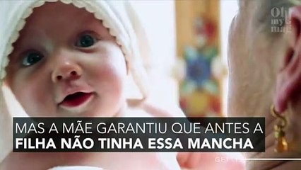 Esta mãe vê uma mancha marrom na boca de seu bebê e acaba envergonhada no hospital