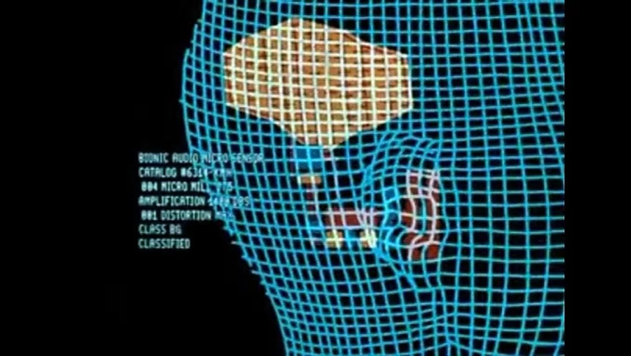 Bionic Woman – Trastorno Mental (2P)