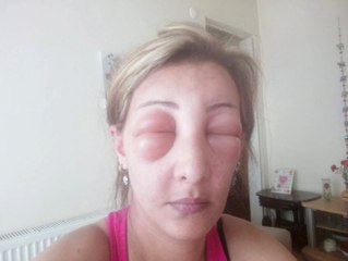 Saçını boyatmak için girdiği kuaförde hastanelik oldu