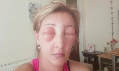 Saçlarını yaptırmak için kuaföre gitti, canından oluyordu