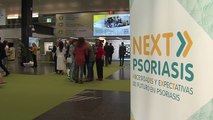 Uno de cada cuatro pacientes con psoriasis en España no recibe tratamiento