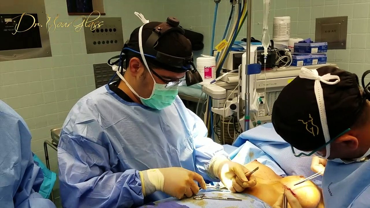 How long do you have to sleep on your back after breast augmentation?