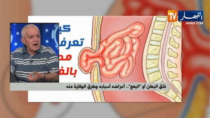 فتق البطن أو "البعج"..أعراضه وأسبابه وطرق الوقاية منه