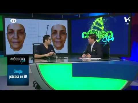 Tecnología 3D para mejorar la cirugía plástica, ¿cómo funciona?