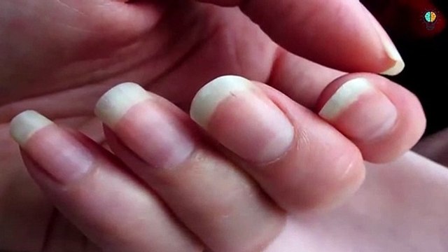 هل تعلم ماذا سيحدث لك إذا إختفى شكل نصف القمر على الاظافر ؟