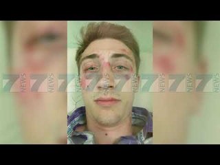 PROTESTA MASIVE KUNDER ALEKSANDER VUÇIÇ, DHUNE GJATE TUBIMIT - News, Lajme - Kanali 7