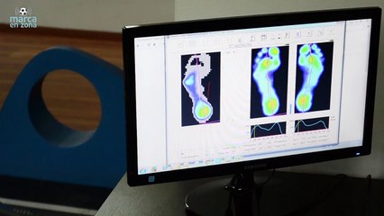 “Los problemas de mis dolores de postura se solucionaron con las plantilas”