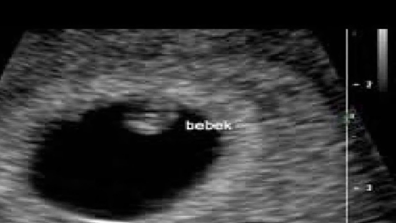 3 HAFTALIK GEBELİK HAMİLELİK ÜÇ HAFTALIK GEBELİK