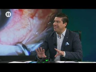 Riesgos y beneficios de un trasplante de córnea