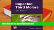 Review  Impacted Third Molars - John Wayland