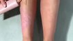 Kim Kardashian Covers Her Psoriasis Legs With KKW Beauty Body Makeup