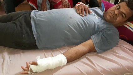 पति ने पत्नी के प्रेमी का तलवार से काट दिया हाथ