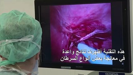 تقنية جديدة تبعث الأمل لدى مرضى سرطان المعدة