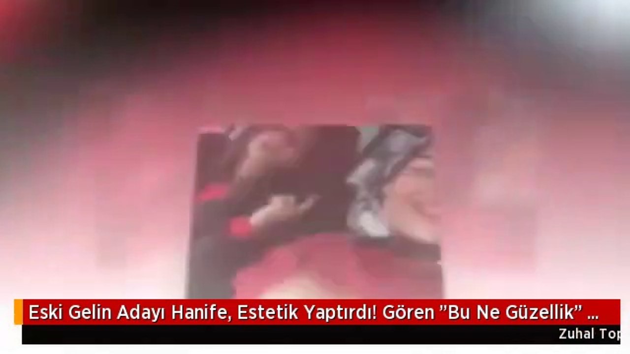 Eski Gelin Adayı Hanife, Estetik Yaptırdı!