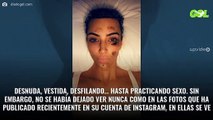 Las bestiales fotos de Kim Kardashian con psoriasis en la cara (y tienen horas)
