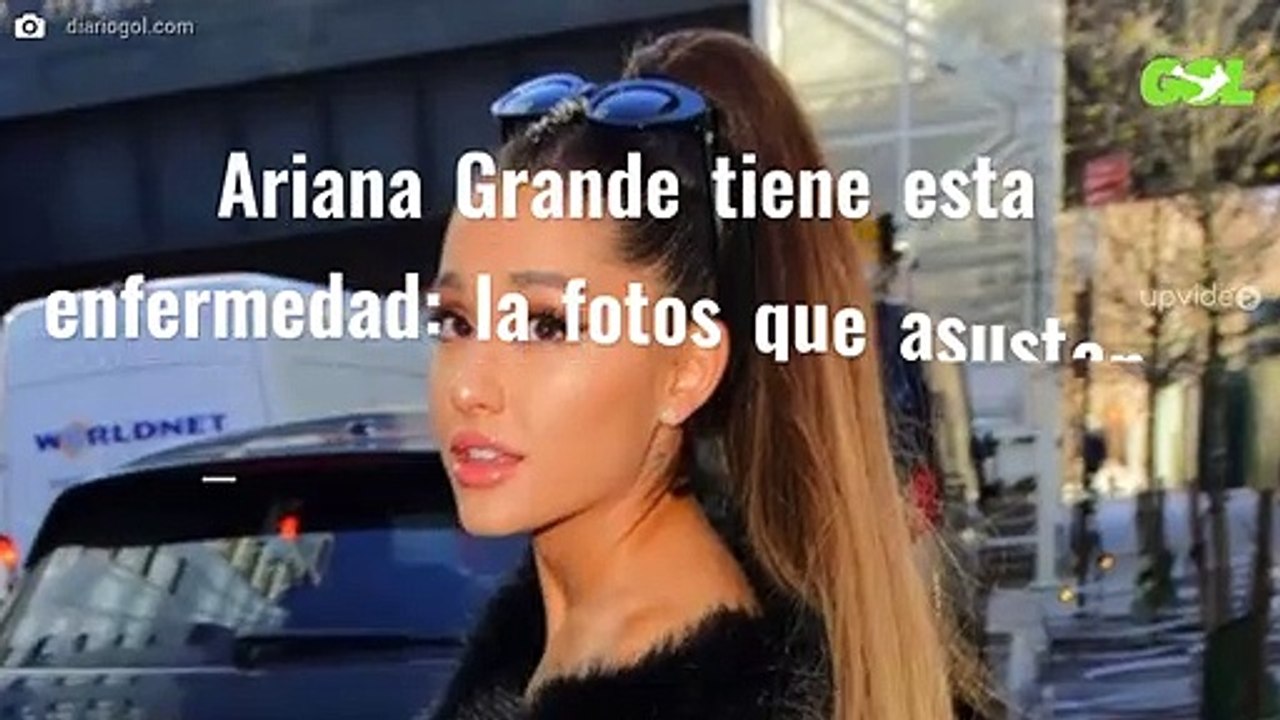 Ariana Grande tiene esta enfermedad: la fotos que asustan a Taylor Swift y Miley Cyrus