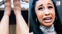 Cardi B Vows To Never Get Plastic Surgery Again After Swollen Feet!