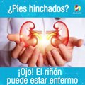 Señales que indican enfermedad renal