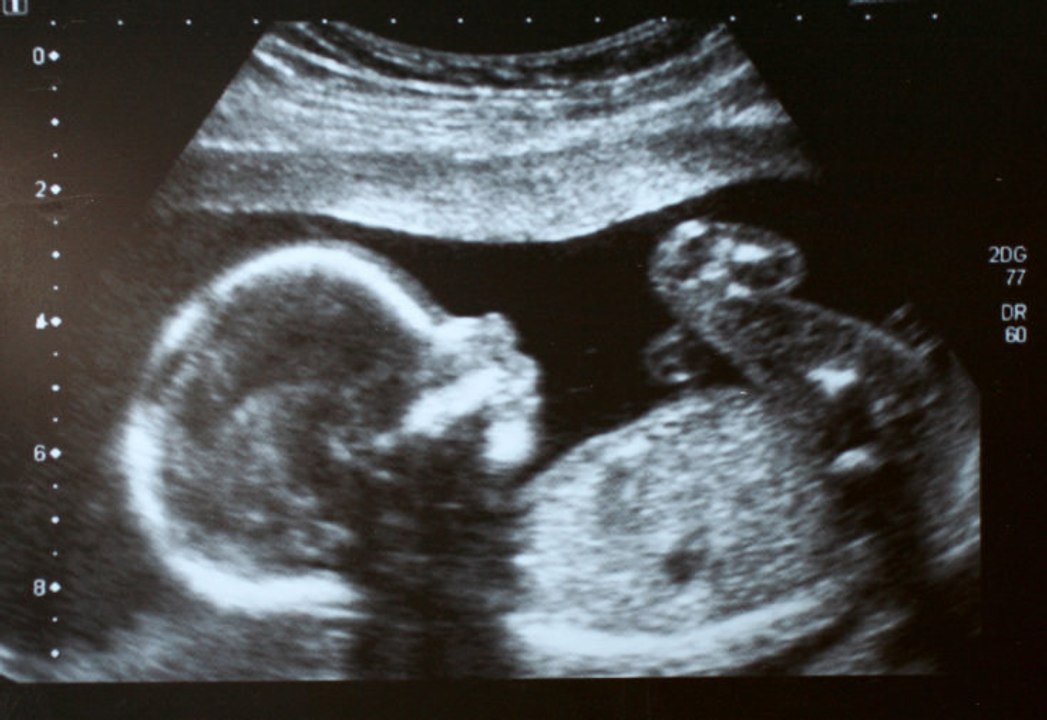 Cette nouvelle technique d’IRM permet d’obtenir les images de grossesse les plus détaillées jamais enregistrées