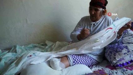 Evladının feryatları yürekleri burkmuştu...Tedavisi gecikince kangren olan bacağı kesildi