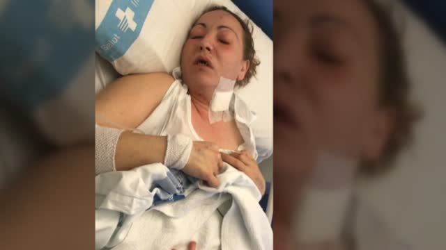 Una mujer herida en Tarragona tras precipitarse desde un tercer piso