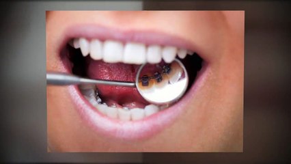 Summerlin Orthodontist