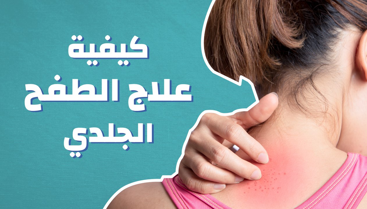 كيفية علاج الطفح الجلدي