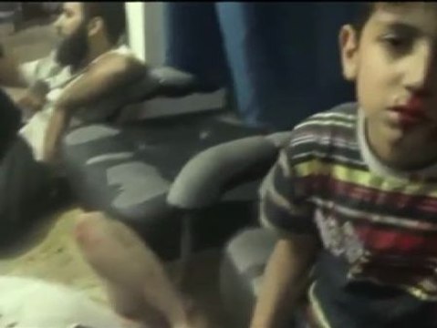 La brutalidad de la guerra civil en Siria golpea a los más inocentes